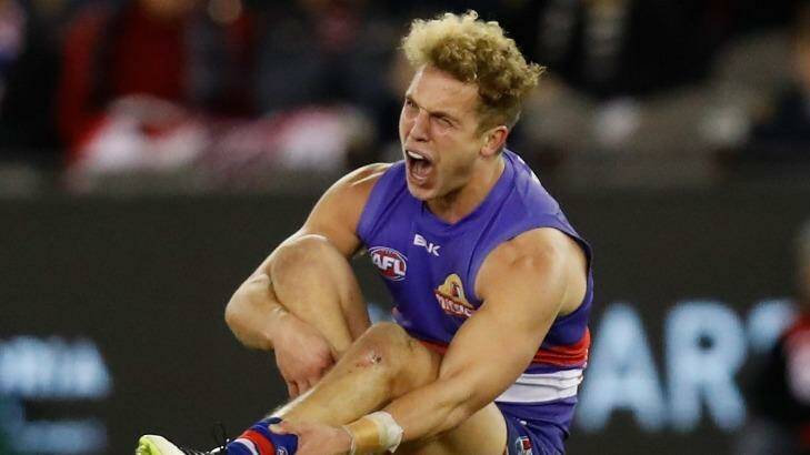 Mitch Wallis howls in agony after breaking his leg. Photo: AFL Media/Getty Images