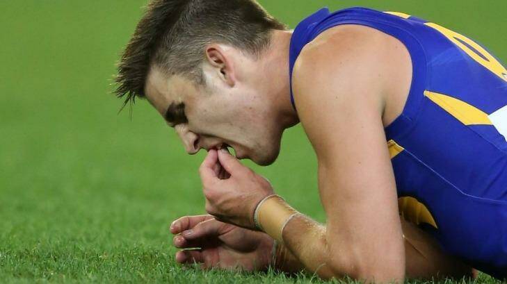 West Coast's Elliot Yeo lost part of two front teeth in 2014. He has since re-injured his hand. Photo: Michael Dodge