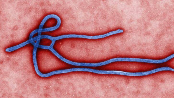 The Ebola virus. Photo: Centres for Disease Control