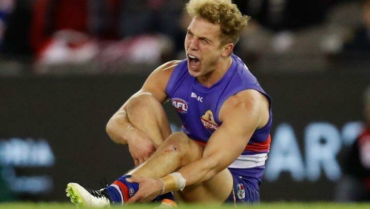 Wallis shows the pain of a broken leg. Photo: AFL Media/Getty Images