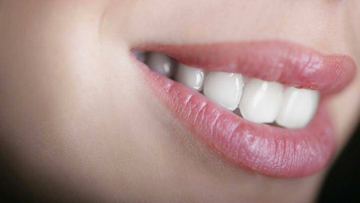 It'a all smiles for Colgate. Photo: iStock
