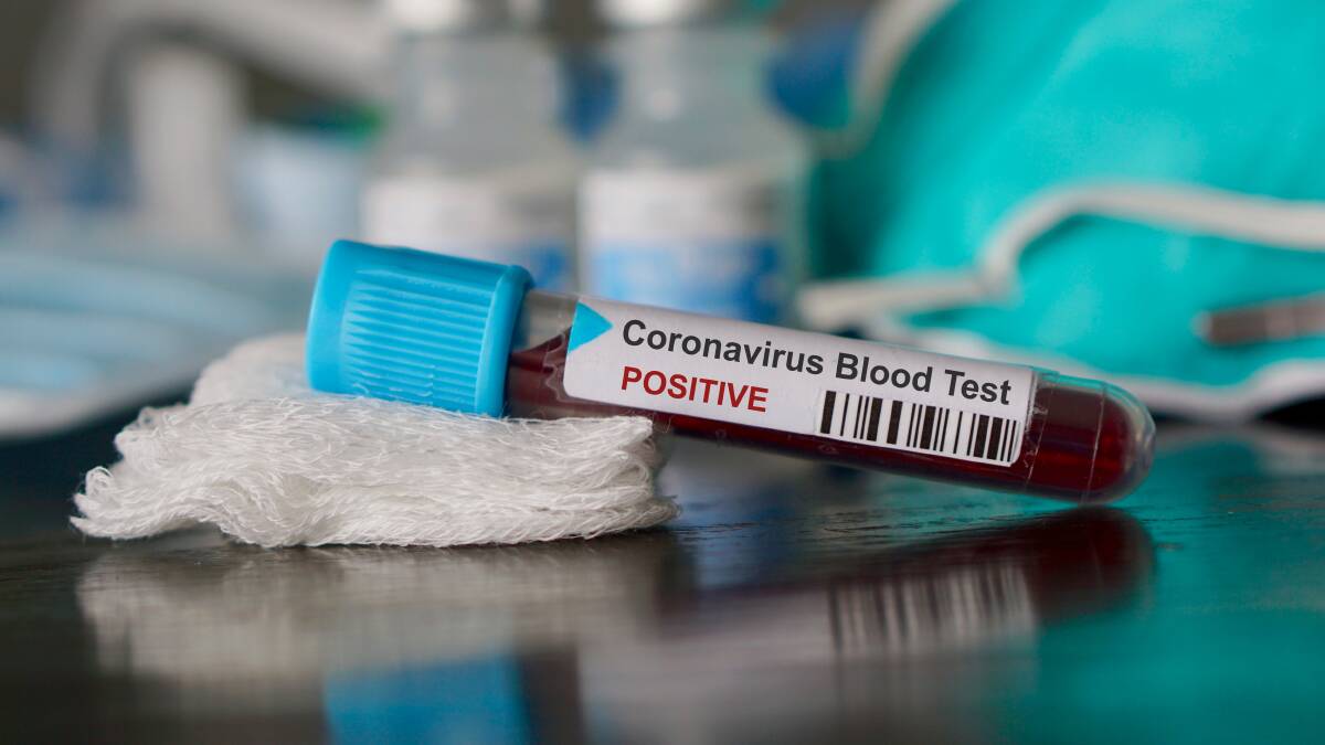 Forty new cases of COVID-19 in Queensland on Friday